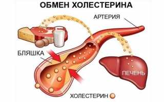 Какая норма холестерина должна быть у женщины