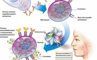 Ринит и лечение насморка различной этиологии
