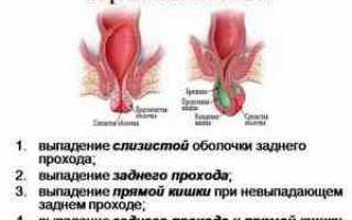 Алая кровь из заднего прохода при дефекации