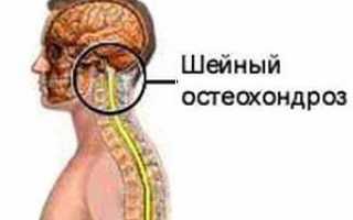 Эффективные методы лечения остеохондроза шейного отдела позвоночника народными средствами: целебные рецепты и полезные упражнения