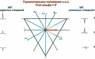 Промежуточная электрическая позиция сердца