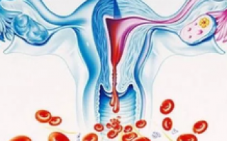 Чем можно остановить маточное кровотечение