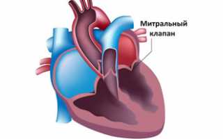 Митральный клапан противофаза есть что значит