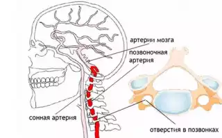 Может шейный остеохондроз повышать давление