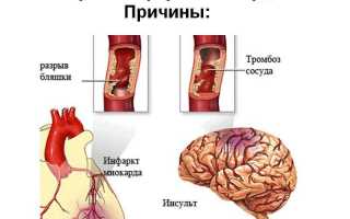 Актилизе инструкция по применению при инфаркте