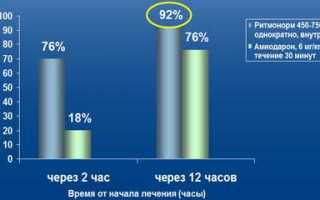 Купирование пароксизма мерцательной аритмии