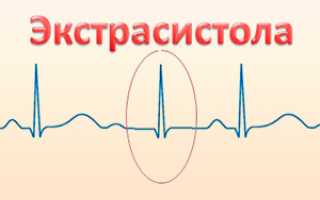 Парные экстрасистолы в сердце опасно ли это