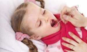 Чем советует лечить красное горло у ребенка доктор Комаровский?