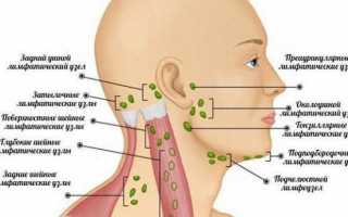 Почему у ребенка воспалился лимфоузел за ухом?