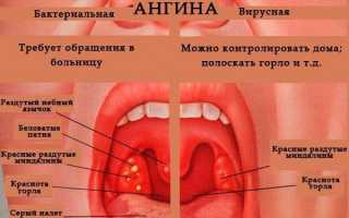 Какой анализ крови при ангине нужно сдать?