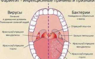 Как лечить горло ребенку до 2 лет?